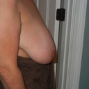 before side