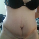 close up-23 days post op
