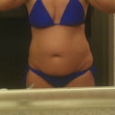 Night before surgery