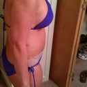 5 days post op