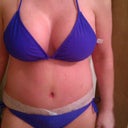 5 days post op