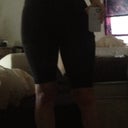 5 days post op