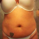 Before tt and lipo