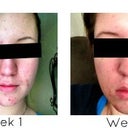 Front View of Month 1.
