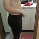 3rd day post op - Ugly Cones :\