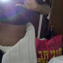 Post op Day 3 - This was taken in the morning when I usually not that swollen
