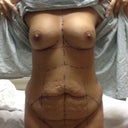 Right before I went back! YUK!
