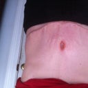 Front 4 weeks po