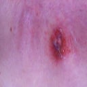 Oooky belly button needs to heal!