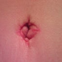 bb, 3 weeks 2 days po. no stitches! (:
