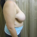 Only 20 and very saggy breast.