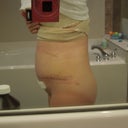 Swelling.  The most swollen I have been the entire time.