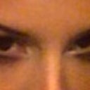 2 days after Juvederm- looking down, with only a little bit of concealer on. Very happy!