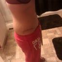4 months post op