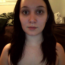 After - front; 2 months, 8 days post-op (taken April 26th)