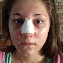 This is day 2. I just woke up