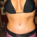 2 weeks post-op