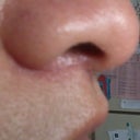 pictures of the scar
