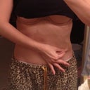 Me pinching fat on the right side of my body. Notice the large difference between this and the last picture.