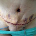 Pod 3. Not sure why I bruised so much....