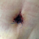 New belly button close up