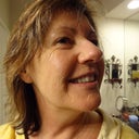Before photo showing wrinkling around eyes, mouth and yellowish skin tone from sun exposure over the years.
