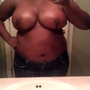 5 days post op