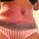BB still has swelling around it