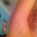 Day 3 right armpit.