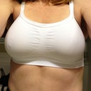 1 1/2 week post op
