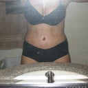 2 weeks post op