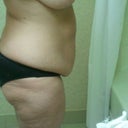 Side view morning of sx.