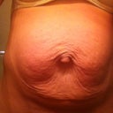 My before picture. So awful with diastasis and wrinkled skin. Wouldn't even let my husband see this.