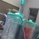 Just over 1.6 liters of fat taken out by Vaser hi def Liposuction.