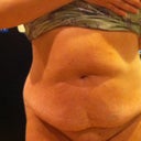 Front view.  My belly looks as if it has a beady lil eye watching you.  YIKES!
