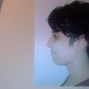 Pre op side profile