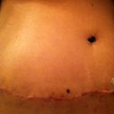 more scar and tummy...swollen