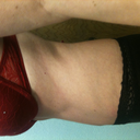 2 mo side