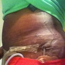 see the little lip hanging?