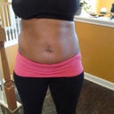 Taken two days before surgery {Front View}