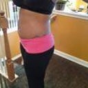 Taken two days before surgery {Left Side}