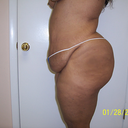 Before (side view)