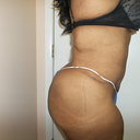 After (side view)