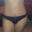 4 weeks post op