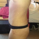 4 weeks post op
