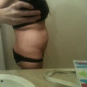 Day before surgery, profile: ready for this to be gone