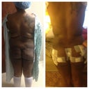 Before and after