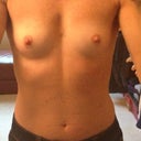 Before surgery