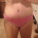 13 days PO - still hard to believe this is MY body!  What?