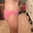 13 Day PO from side - almost standing up straight now